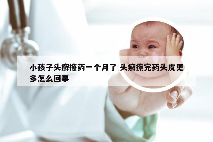 小孩子头癣擦药一个月了 头癣擦完药头皮更多怎么回事