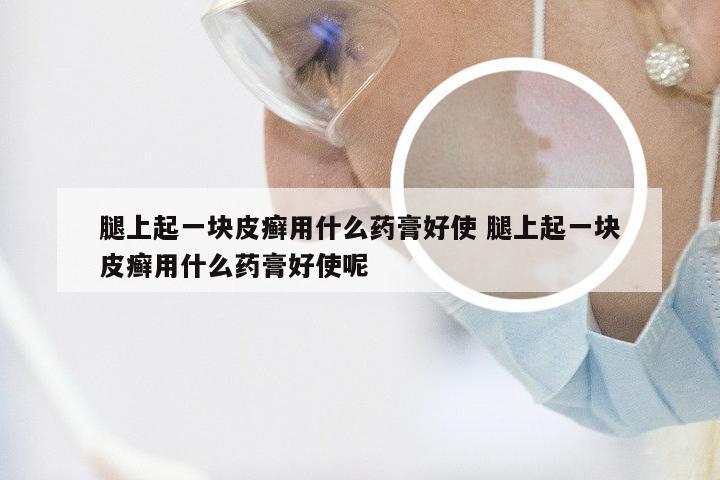 腿上起一块皮癣用什么药膏好使 腿上起一块皮癣用什么药膏好使呢