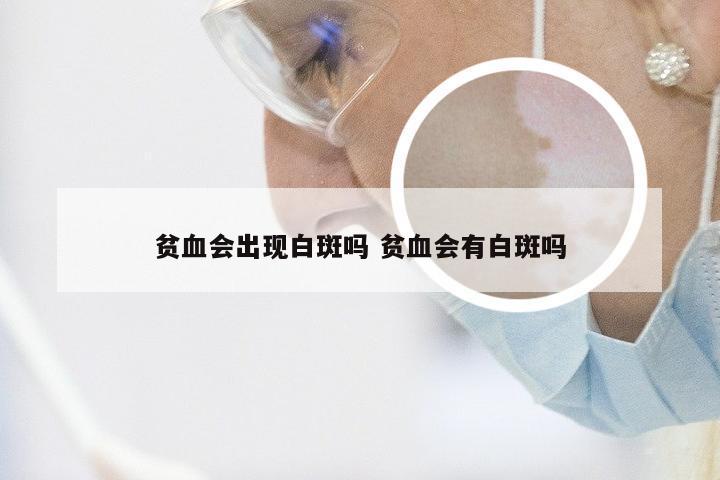 贫血会出现白斑吗 贫血会有白斑吗