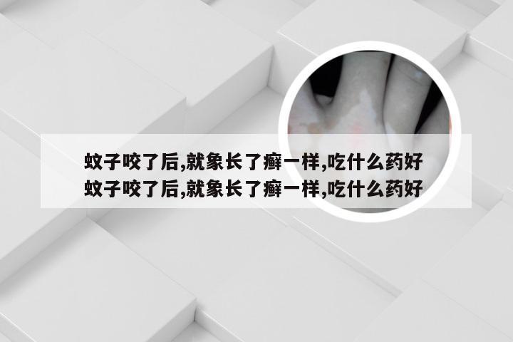 蚊子咬了后,就象长了癣一样,吃什么药好 蚊子咬了后,就象长了癣一样,吃什么药好