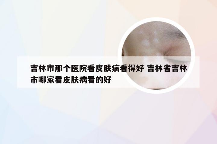 吉林市那个医院看皮肤病看得好 吉林省吉林市哪家看皮肤病看的好