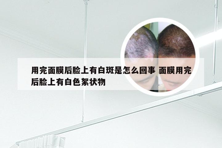 用完面膜后脸上有白斑是怎么回事 面膜用完后脸上有白色絮状物