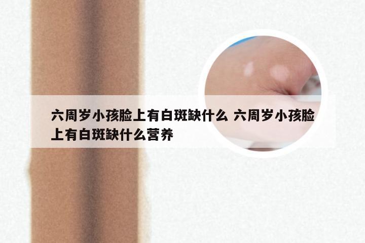 六周岁小孩脸上有白斑缺什么 六周岁小孩脸上有白斑缺什么营养