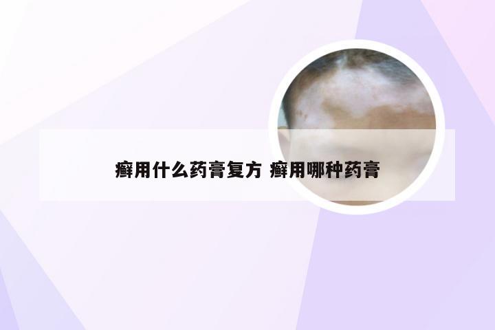 癣用什么药膏复方 癣用哪种药膏