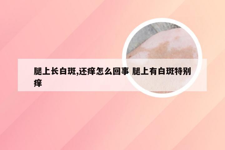 腿上长白斑,还痒怎么回事 腿上有白斑特别痒