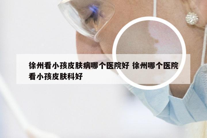 徐州看小孩皮肤病哪个医院好 徐州哪个医院看小孩皮肤科好