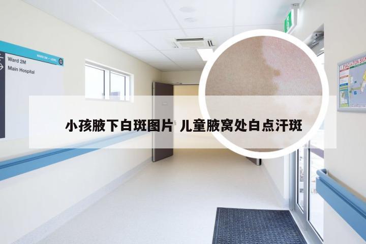 小孩腋下白斑图片 儿童腋窝处白点汗斑