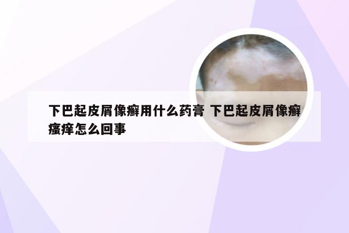 下巴起皮屑像癣用什么药膏 下巴起皮屑像癣瘙痒怎么回事