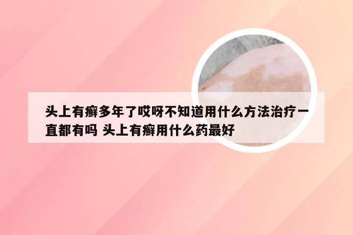 头上有癣多年了哎呀不知道用什么方法治疗一直都有吗 头上有癣用什么药最好