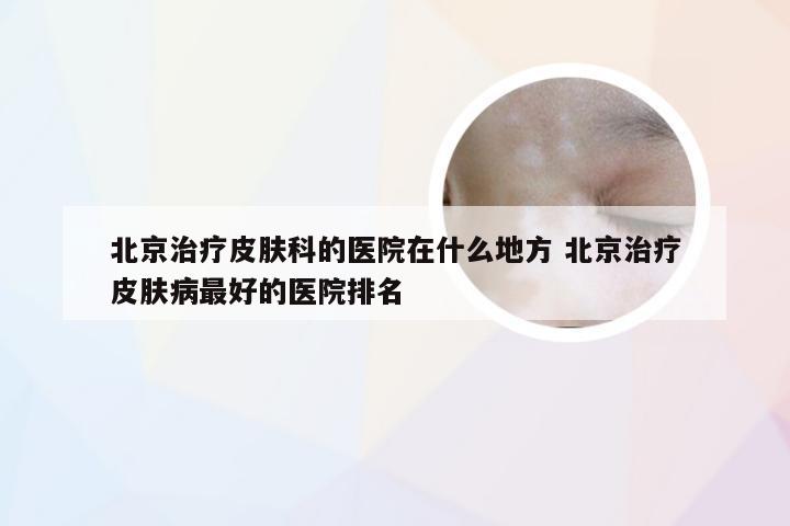 北京治疗皮肤科的医院在什么地方 北京治疗皮肤病最好的医院排名