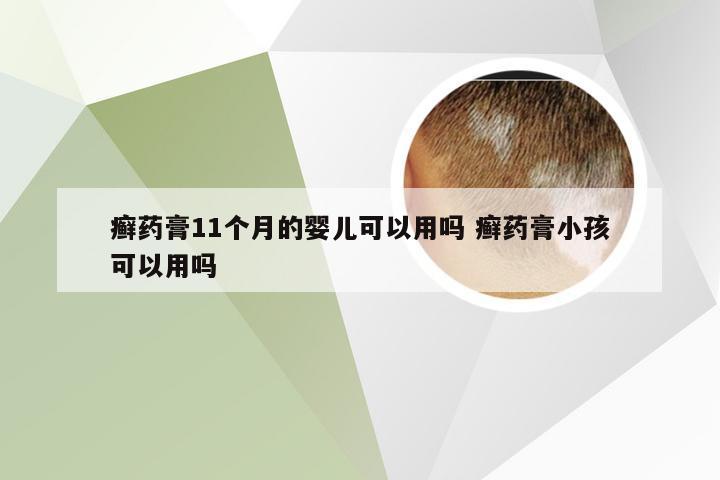 癣药膏11个月的婴儿可以用吗 癣药膏小孩可以用吗