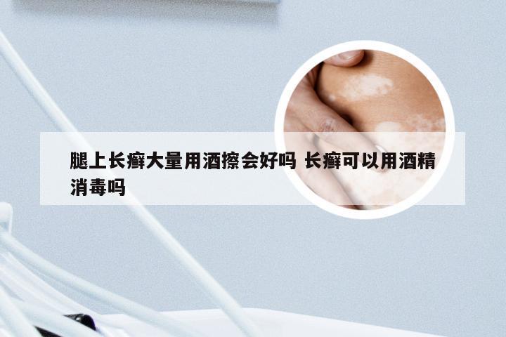 腿上长癣大量用酒擦会好吗 长癣可以用酒精消毒吗