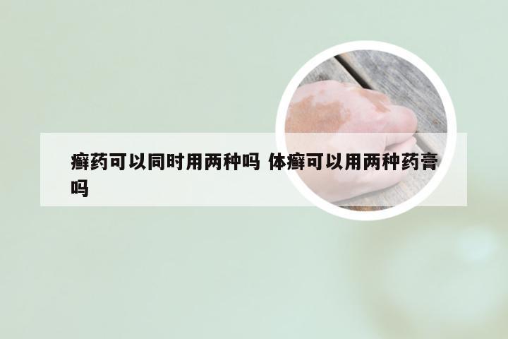 癣药可以同时用两种吗 体癣可以用两种药膏吗