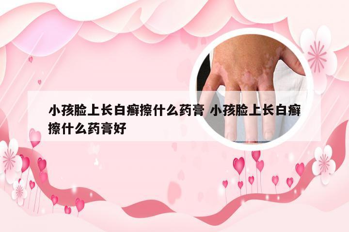 小孩脸上长白癣擦什么药膏 小孩脸上长白癣擦什么药膏好