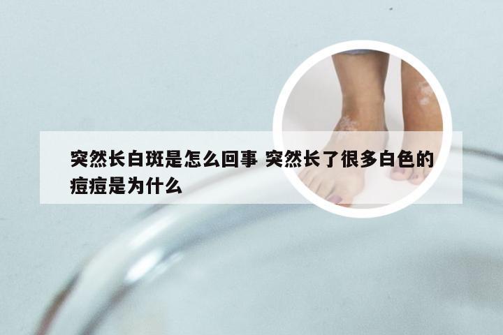 突然长白斑是怎么回事 突然长了很多白色的痘痘是为什么