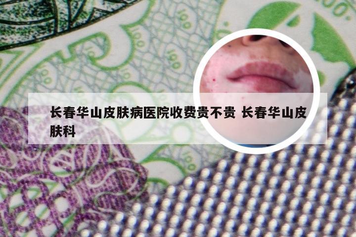 长春华山皮肤病医院收费贵不贵 长春华山皮肤科