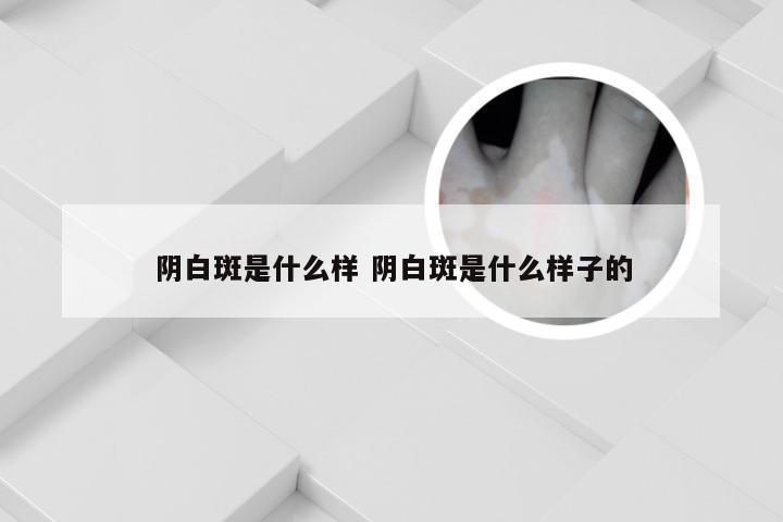 阴白斑是什么样 阴白斑是什么样子的