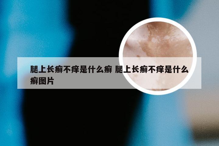 腿上长癣不痒是什么癣 腿上长癣不痒是什么癣图片