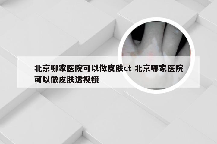 北京哪家医院可以做皮肤ct 北京哪家医院可以做皮肤透视镜