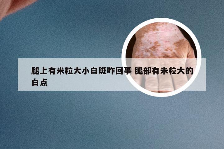 腿上有米粒大小白斑咋回事 腿部有米粒大的白点