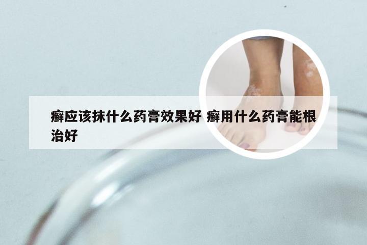 癣应该抹什么药膏效果好 癣用什么药膏能根治好