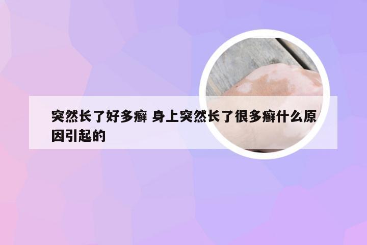 突然长了好多癣 身上突然长了很多癣什么原因引起的