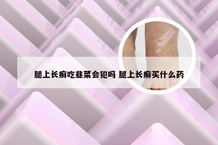 腿上长癣吃韭菜会犯吗 腿上长癣买什么药