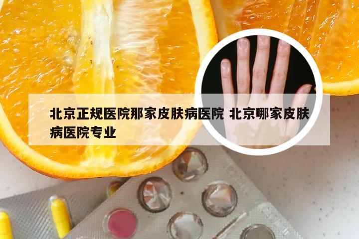 北京正规医院那家皮肤病医院 北京哪家皮肤病医院专业