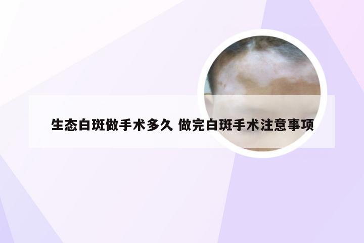 生态白斑做手术多久 做完白斑手术注意事项