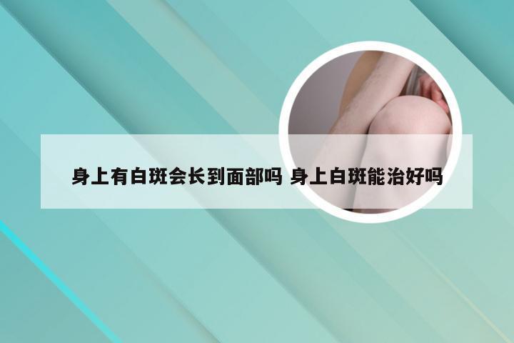 身上有白斑会长到面部吗 身上白斑能治好吗