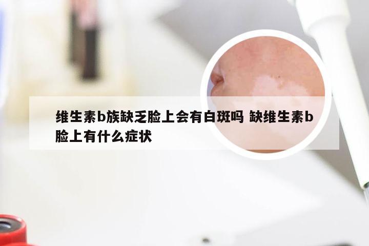 维生素b族缺乏脸上会有白斑吗 缺维生素b脸上有什么症状