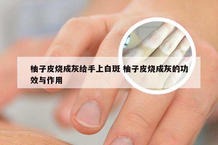 柚子皮烧成灰给手上白斑 柚子皮烧成灰的功效与作用