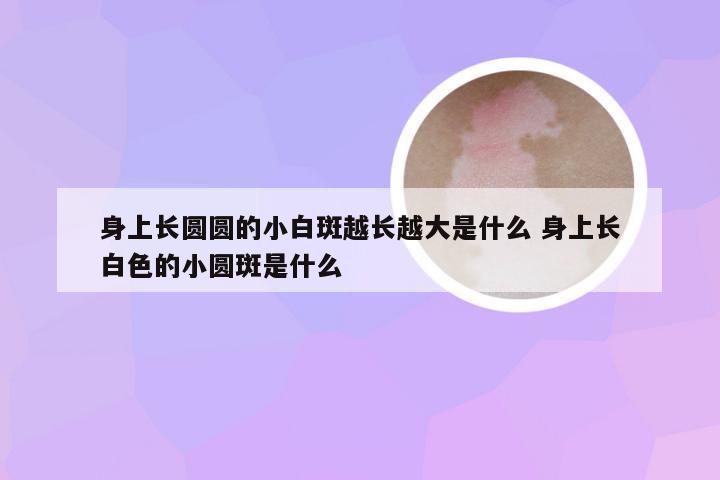 身上长圆圆的小白斑越长越大是什么 身上长白色的小圆斑是什么