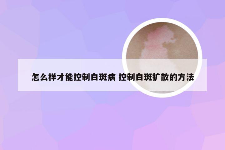 怎么样才能控制白斑病 控制白斑扩散的方法