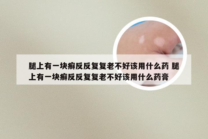 腿上有一块癣反反复复老不好该用什么药 腿上有一块癣反反复复老不好该用什么药膏