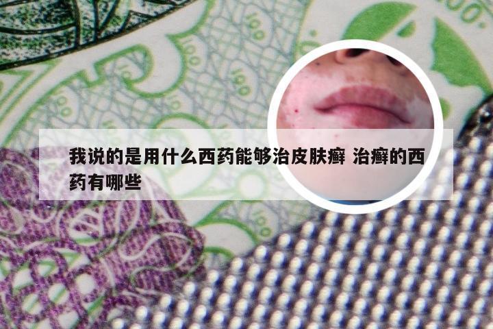 我说的是用什么西药能够治皮肤癣 治癣的西药有哪些