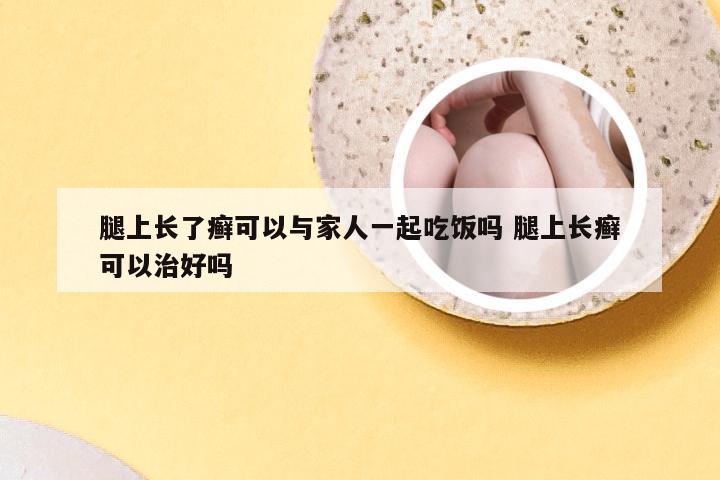 腿上长了癣可以与家人一起吃饭吗 腿上长癣可以治好吗