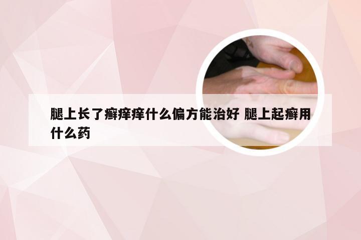 腿上长了癣痒痒什么偏方能治好 腿上起癣用什么药