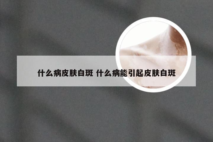 什么病皮肤白斑 什么病能引起皮肤白斑