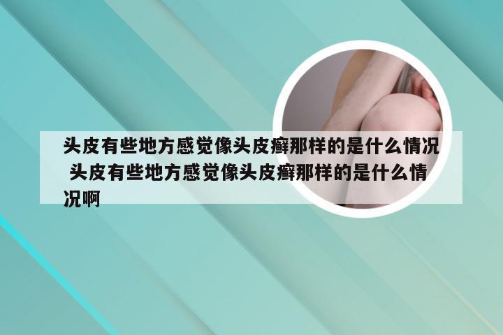 头皮有些地方感觉像头皮癣那样的是什么情况 头皮有些地方感觉像头皮癣那样的是什么情况啊