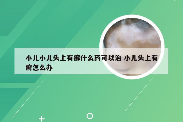 小儿小儿头上有癣什么药可以治 小儿头上有癣怎么办