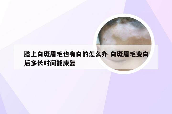 脸上白斑眉毛也有白的怎么办 白斑眉毛变白后多长时间能康复