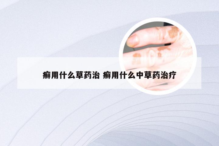 癣用什么草药治 癣用什么中草药治疗