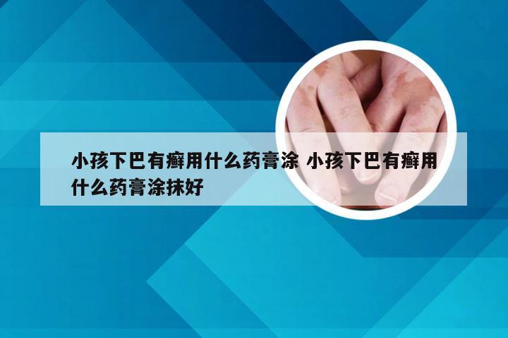 小孩下巴有癣用什么药膏涂 小孩下巴有癣用什么药膏涂抹好