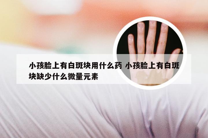 小孩脸上有白斑块用什么药 小孩脸上有白斑块缺少什么微量元素