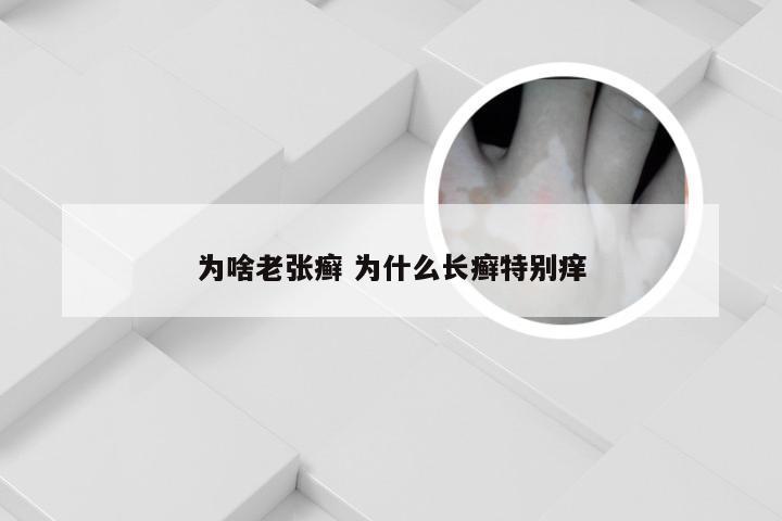 为啥老张癣 为什么长癣特别痒