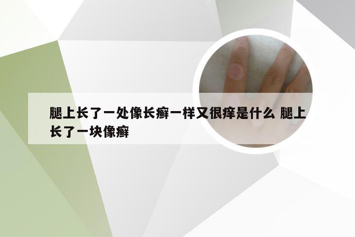 腿上长了一处像长癣一样又很痒是什么 腿上长了一块像癣