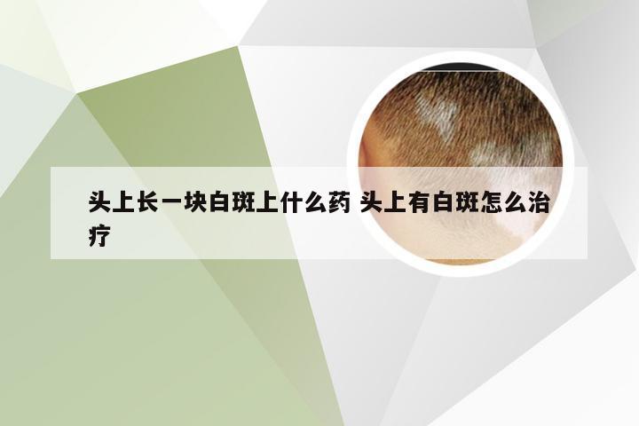 头上长一块白斑上什么药 头上有白斑怎么治疗