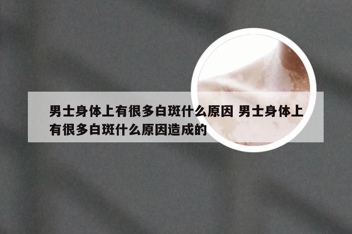 男士身体上有很多白斑什么原因 男士身体上有很多白斑什么原因造成的