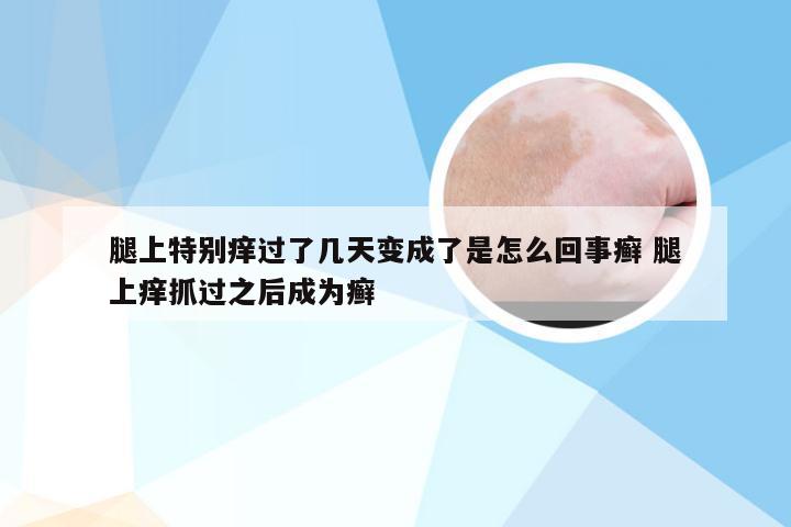 腿上特别痒过了几天变成了是怎么回事癣 腿上痒抓过之后成为癣